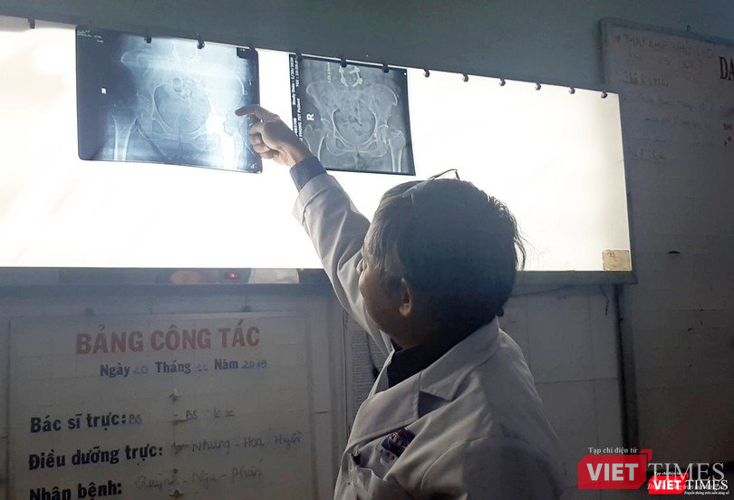 Bác sĩ Tăng Hà Nam Anh – Khoa Chấn thương Chỉnh hình (BV Nguyễn Tri Phương TP.HCM) chia sẻ về kỹ thuật thay khớp háng SuperPath và thay khớp gối Medial Pivot. Ảnh: NT