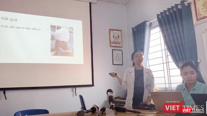 Thạc sĩ - BS Diệp Quế Trinh - Phó khoa Phỏng tạo hình (BV Nhi đồng 1 TP.HCM) chia sẻ về ca bệnh (Ảnh: Nguyễn Trăm)