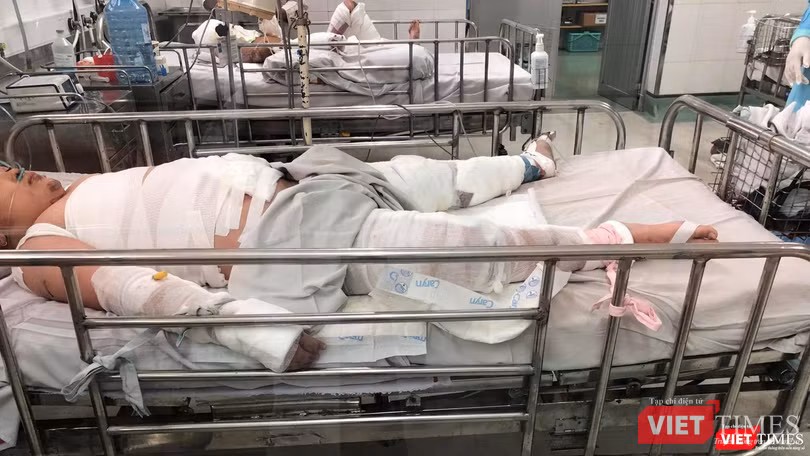 Cả ba cha con cùng bị bỏng rất nặng sau vụ châm lửa đốt nhà (Ảnh: MT)