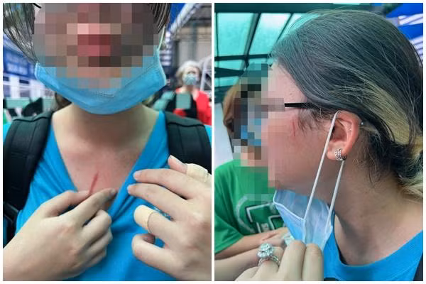 Hình ảnh từ livestream cho thấy các nữ sinh bị nhiều vết thương sau vụ ẩu đả