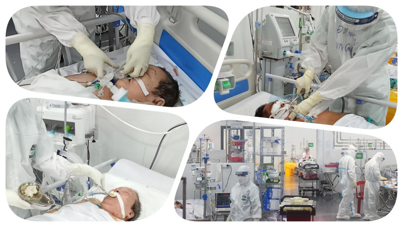 Chăm sóc bệnh nhân nặng COVID-19 tại Trung tâm Hồi sức tích cực người bệnh COVID-19 (BV Trung ương Huế tại TP.HCM). Ảnh: Hoà Bình