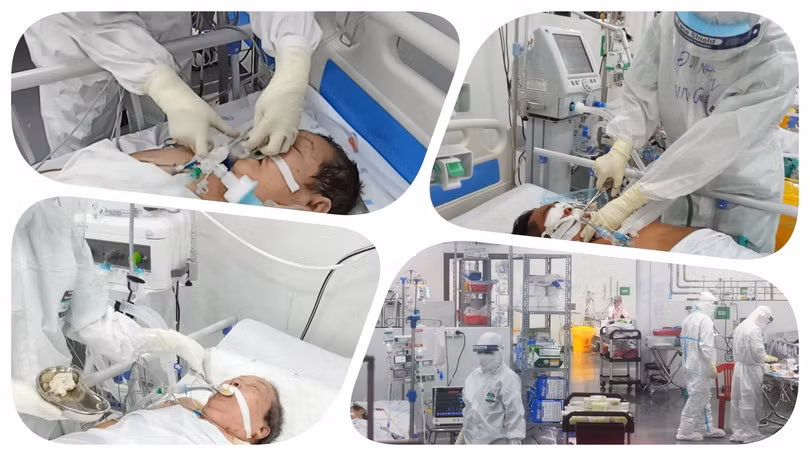 Chăm sóc bệnh nhân nặng COVID-19 tại Trung tâm Hồi sức tích cực người bệnh COVID-19 (BV Trung ương Huế tại TP.HCM). Ảnh: Hoà Bình