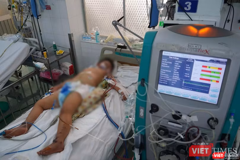 TP.HCM đã có 2 ca tử vong vì sốt xuất huyết, trong đó có 1 trẻ em và 1 phụ nữ. Ảnh: HCDC