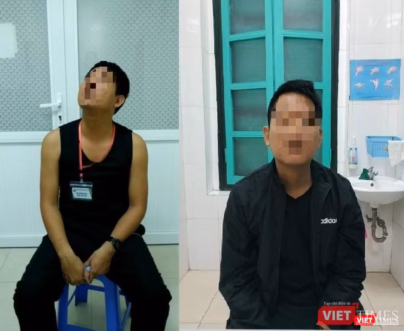 Bệnh nhân L.Đ.T, điều trị loạn trương lực cơ cổ bằng phương pháp tiêm Botulinum toxin tại Khoa Nội Hồi sức thần kinh. Ảnh trước (bên trái) và sau tiêm (bên phải) - (Ảnh: BVCC)