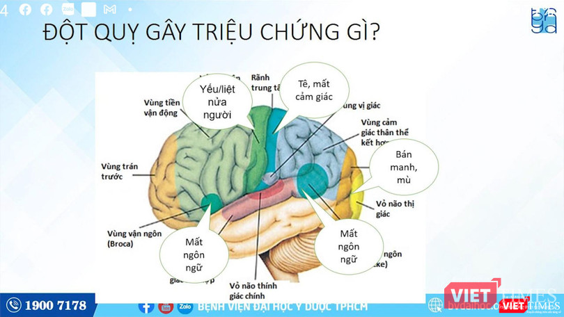 BS Thắng phân tích về các hậu quả nặng nề của bệnh đột quỵ (Ảnh: BVCC) BS Thắng phân tích về các hậu quả nặng nề của bệnh đột quỵ (Ảnh: BVCC)