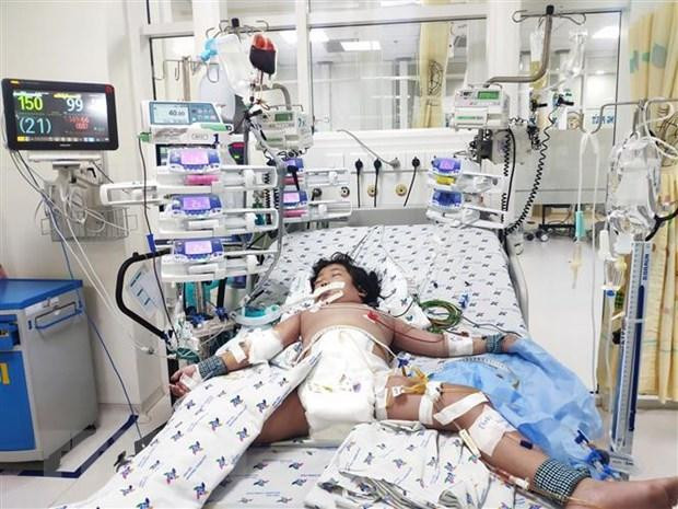 Bệnh nhi sốc sốt xuất huyết được các BS tận tình cứu chữa (Ảnh: TTXVN)