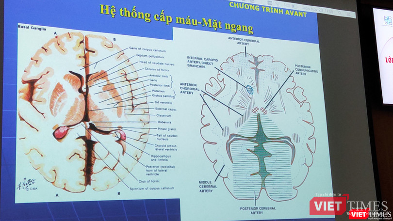 Hình ảnh phân tich hệ thống cấp máu - mặt ngang (Ảnh: Hoà Bình) Hình ảnh phân tich hệ thống cấp máu - mặt ngang (Ảnh: Hoà Bình)