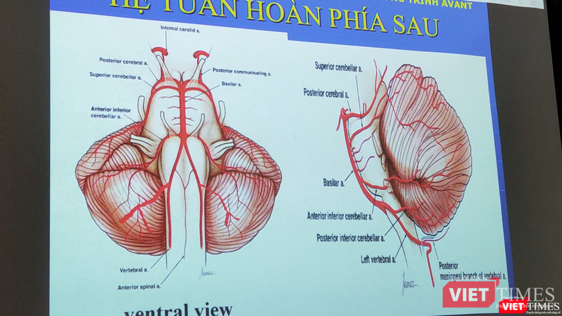 BS Nguyễn Bá Thắng – Trưởng khoa Thần kinh, BV Đại học Y Dược TP.HCM nhấn mạnh chẩn đoán định khu tổn thương rất quan trọng (Ảnh: Hoà Bình) BS Nguyễn Bá Thắng – Trưởng khoa Thần kinh, BV Đại học Y Dược TP.HCM nhấn mạnh chẩn đoán định khu tổn thương rất quan trọng (Ảnh: Hoà Bình)