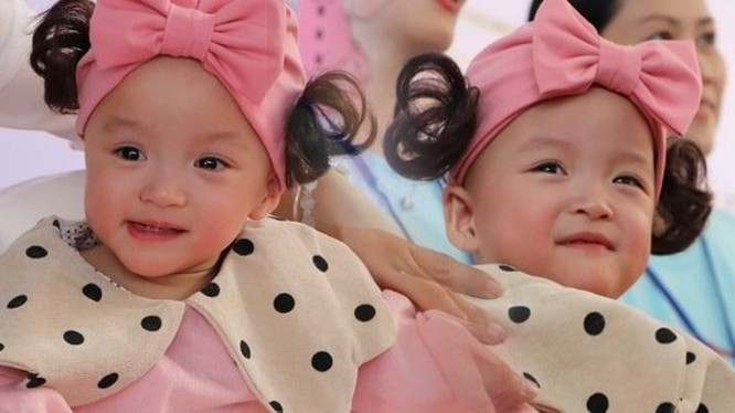 Trúc Nhi - Diệu Nhi cười thật tươi ngày xuất viện (Ảnh: PLCS)