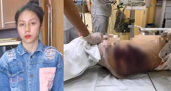 "Dì ghẻ" Nguyễn Võ Quỳnh Trang hành hạ bé gái 8 tuổi tới chết bị khởi tố bổ sung tội danh giết người