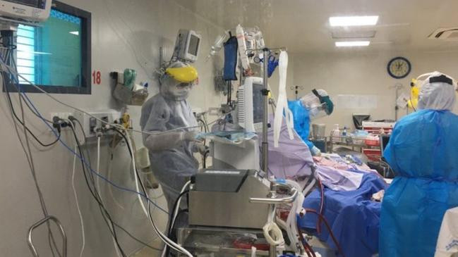 BN 2983 đang được các bác sĩ hồi sức tích cực tại BV Bệnh Nhiệt đới TP.HCM - Ảnh: BVCC 