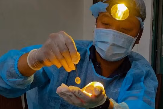 Giác mạc sinh học mở hy vọng cho hơn nửa triệu người mù tại Việt Nam