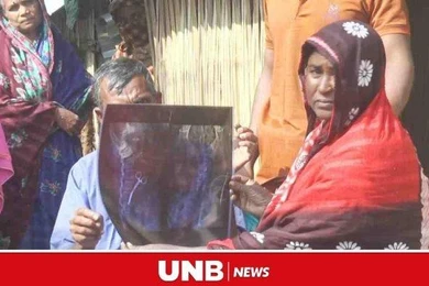 Người phụ nữ phát hiện chiếc kéo nằm trong bụng suốt 20 năm