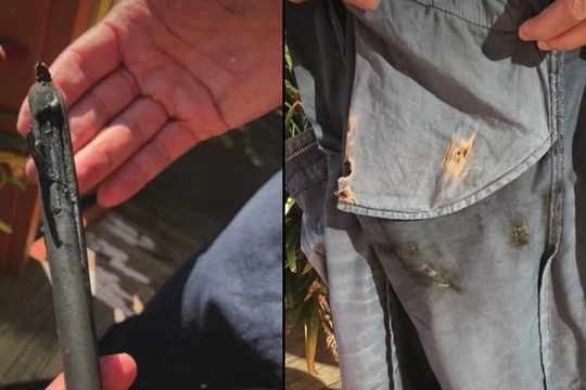  iPhone X phát nổ trong túi quần