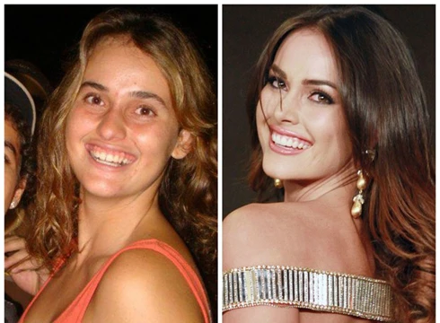 Khủng khiếp việc cắt xương sườn để thi hoa hậu