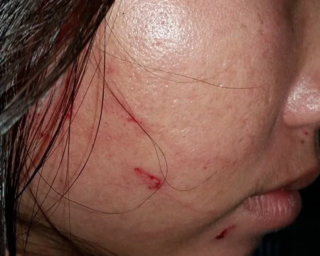 Phản ảnh cân thiếu hải sản, nữ du khách bị đánh rách mặt