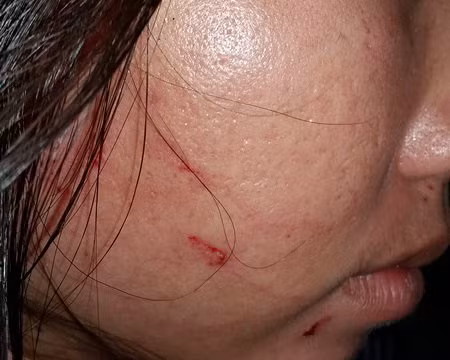 Phản ảnh cân thiếu hải sản, nữ du khách bị đánh rách mặt