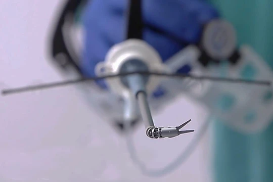 Robot phẫu thuật võng mạc (ảnh minh họa)