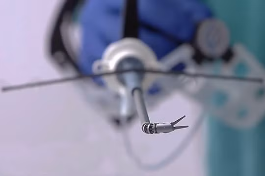 Robot phẫu thuật võng mạc (ảnh minh họa)