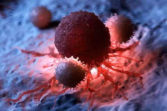 Tấn công tế bào ung thư. Ảnh minh họa