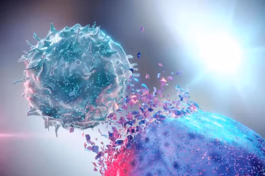 Sau khi điều trị kết hợp xạ trị cứu hộ tuyến tiền liệt tại giường, xạ trị hạch vùng chậu và điều trị loại bỏ androgen. Hơn 87 % bệnh nhân này đã không tái phát ung thư di căn trong vòng 5 năm.