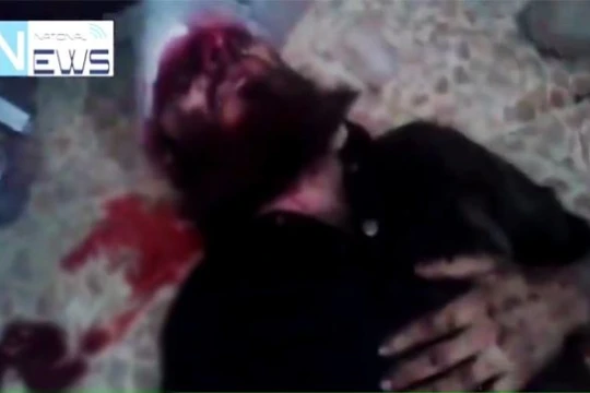 Chiến binh IS bị trọng thương