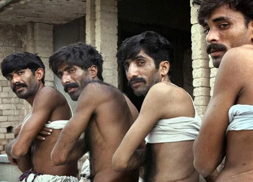 Những nạn nhân Ấn Độ do nghèo đã phải bán đi một phần nội tạng của mình cho những kẻ buôn lậu