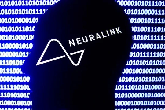 Liên doanh y tế Neuralink. Ảnh CNBC