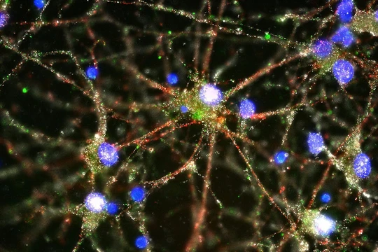 Nơ ron thần kinh ở người.