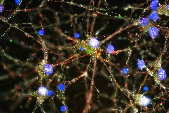 Nơ ron thần kinh ở người.