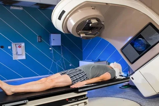 Xạ trị ung thư. Ảnh minh họa Medical News Today.