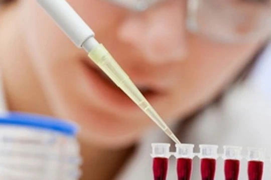 Ảnh minh họa. Nguồn Thanh Niên