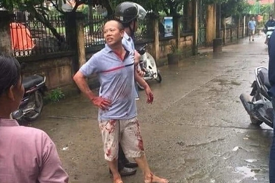 Kẻ gây án Nguyễn Văn Đông bị lực lượng chức năng bắt giữ.