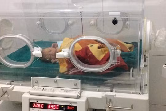 Cháu bé sinh non khi được khoảng 8 tháng và mới chỉ nặng 1,6kg.