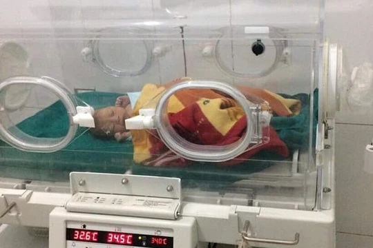 Cháu bé sinh non khi được khoảng 8 tháng và mới chỉ nặng 1,6kg.