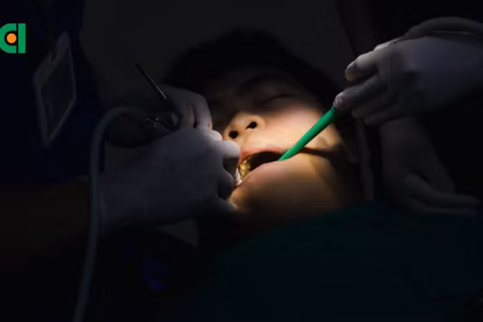 4 răng khôn mọc lệch: Bác sĩ loại bỏ "ám ảnh" cho nam thanh niên bằng công nghệ hiện đại