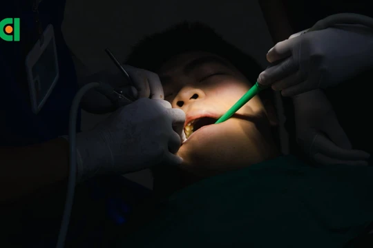 4 răng khôn mọc lệch: Bác sĩ loại bỏ "ám ảnh" cho nam thanh niên bằng công nghệ hiện đại