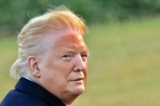 Bức ảnh chụp của William Moon cho thấy da mặt ông Trump có màu da cam, cùng một đường viền màu trắng chạy dọc chân tóc (Ảnh: William Moon)