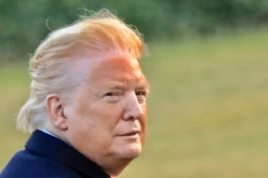 Bức ảnh chụp của William Moon cho thấy da mặt ông Trump có màu da cam, cùng một đường viền màu trắng chạy dọc chân tóc (Ảnh: William Moon)