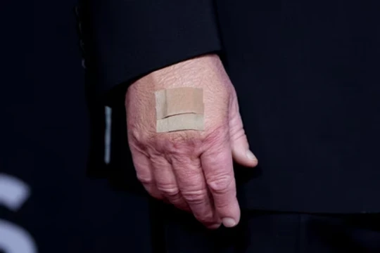 Hình ảnh cận cảnh bàn tay của ông Donald Trump khi ông tạo dáng trên thảm đỏ tại lễ trao giải Kennedy Center Honors năm 2025 ở Trung tâm Biểu diễn Nghệ thuật John F. Kennedy tại Washington, D.C. Ảnh: Reuters.