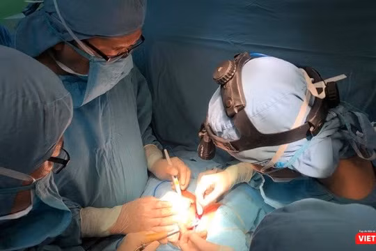 Bác sĩ BV Nhi đồng 1 phẫu thuật tách cặp em bé song sinh dính liền gan