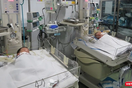 Hai bé song sinh dính liền gan đã được Bệnh viện Nhi đồng 1 phẫu thuật tách rời thành công. Ảnh: Anh Thư