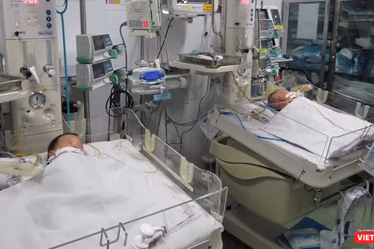 Hai bé song sinh dính liền gan đã được Bệnh viện Nhi đồng 1 phẫu thuật tách rời thành công. Ảnh: Anh Thư