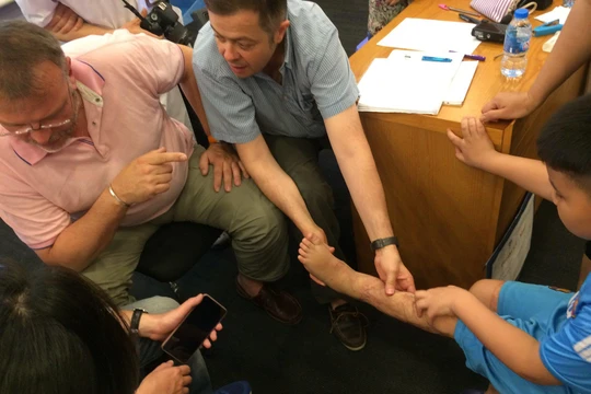 Nhóm bác sĩ nước ngoài khám cho các em nhỏ bị sẹo tại Bệnh viện đa khoa Xanh Pôn.