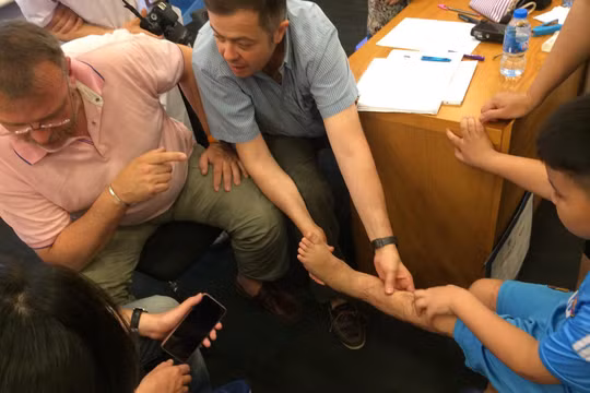 Nhóm bác sĩ nước ngoài khám cho các em nhỏ bị sẹo tại Bệnh viện đa khoa Xanh Pôn.