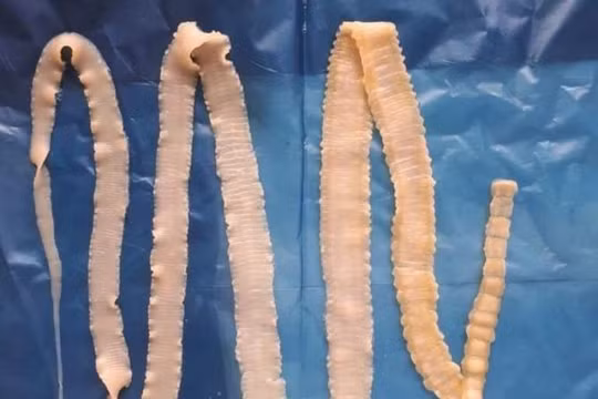 Mẫu sán dây của Viện sốt rét - Ký sinh trùng - Côn trùng TP Hồ Chí Minh