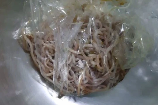 Búi giun to lấy ra khỏi cơ thể của V.