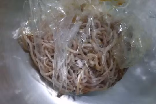 Búi giun to lấy ra khỏi cơ thể của V.