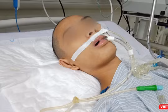 Bệnh nhi hôn mê, thở máy, điều trị đã nhiều ngày tại Khoa Truyền nhiễm, Bệnh viện Nhi Trung ương vì mắc bệnh viêm não Nhật Bản