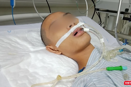 Bệnh nhi hôn mê, thở máy, điều trị đã nhiều ngày tại Khoa Truyền nhiễm, Bệnh viện Nhi Trung ương vì mắc bệnh viêm não Nhật Bản